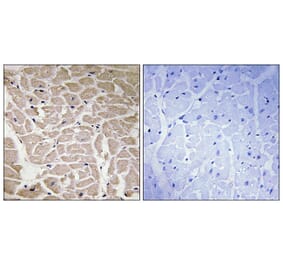 Immunohistochemistry - Anti-Collagen XVI alpha1 Antibody (C12221) - Antibodies.com