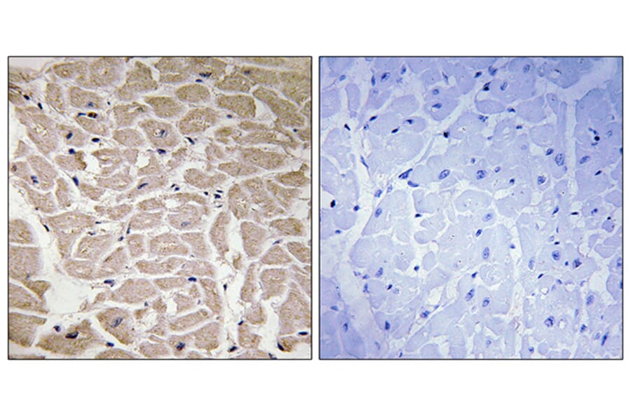 Immunohistochemistry - Anti-Collagen XVI alpha1 Antibody (C12221) - Antibodies.com