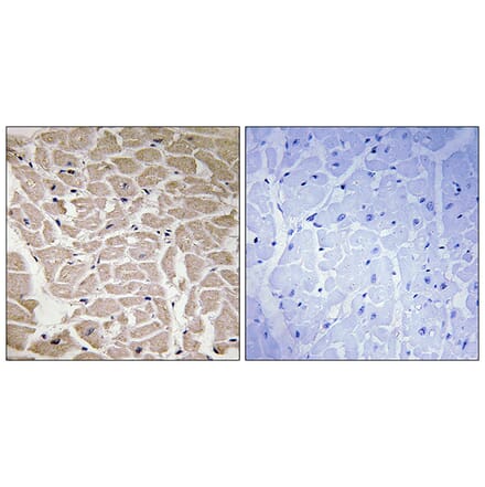 Immunohistochemistry - Anti-Collagen XVI alpha1 Antibody (C12221) - Antibodies.com