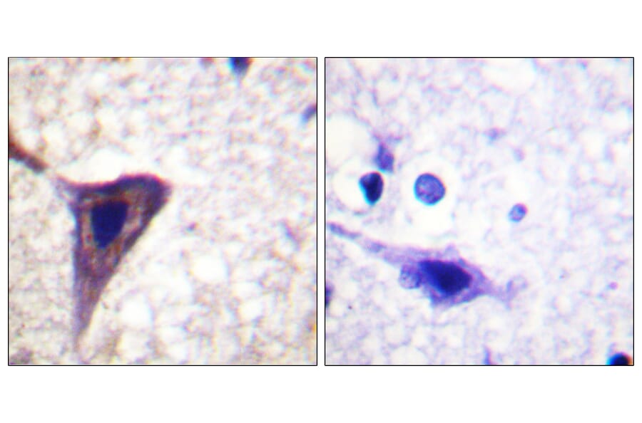 Immunohistochemistry - Anti-BID (phospho Ser78) Antibody (A0461) - Antibodies.com