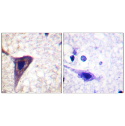 Immunohistochemistry - Anti-BID (phospho Ser78) Antibody (A0461) - Antibodies.com