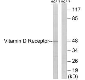 Western Blot - Anti-Vitamin D Receptor Antibody (B1245) - Antibodies.com