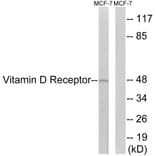 Western Blot - Anti-Vitamin D Receptor Antibody (B1245) - Antibodies.com