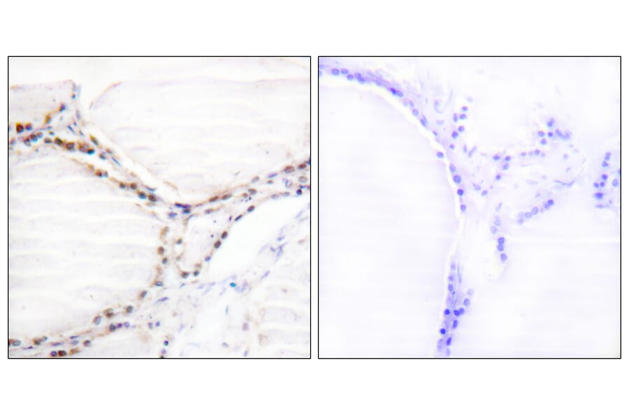 Immunohistochemistry - Anti-Vitamin D Receptor Antibody (B1245) - Antibodies.com