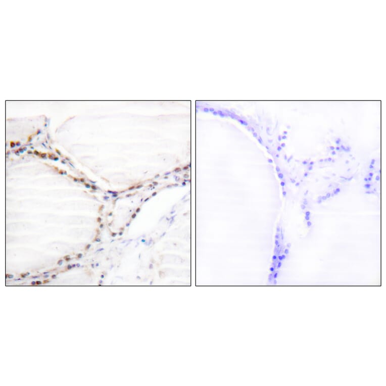 Immunohistochemistry - Anti-Vitamin D Receptor Antibody (B1245) - Antibodies.com