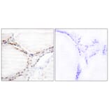 Immunohistochemistry - Anti-Vitamin D Receptor Antibody (B1245) - Antibodies.com