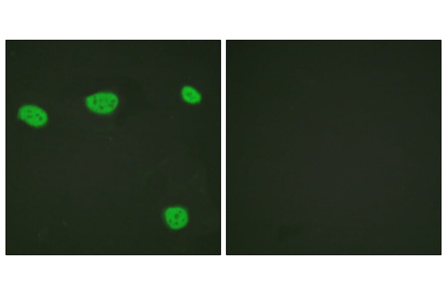 Immunofluorescence - Anti-Vitamin D Receptor Antibody (B1245) - Antibodies.com