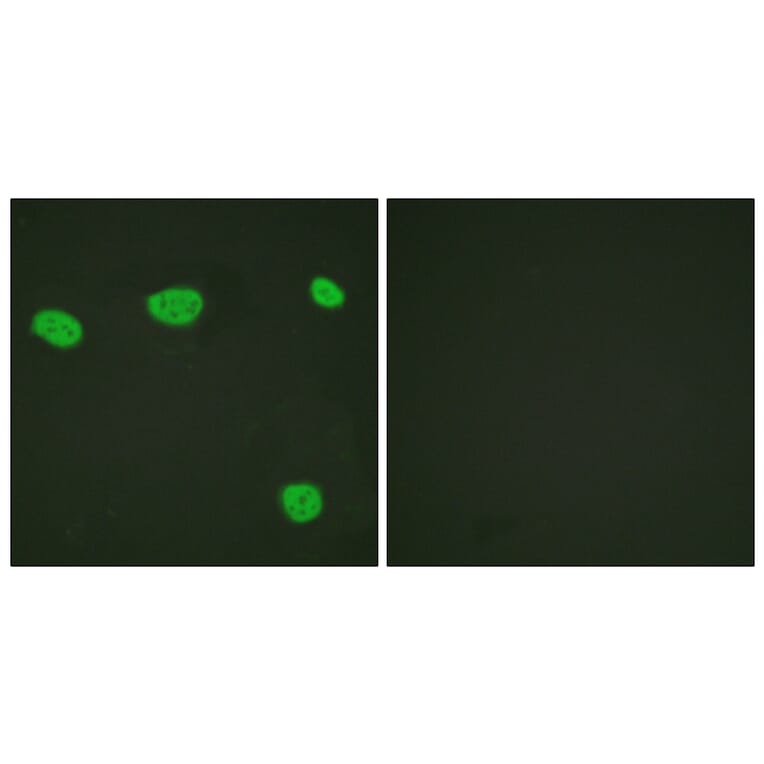 Immunofluorescence - Anti-Vitamin D Receptor Antibody (B1245) - Antibodies.com