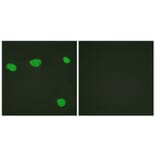 Immunofluorescence - Anti-Vitamin D Receptor Antibody (B1245) - Antibodies.com