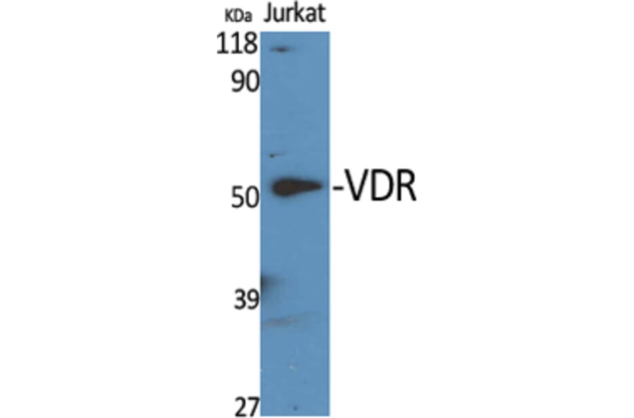 Western Blot - Anti-Vitamin D Receptor Antibody (B1245) - Antibodies.com