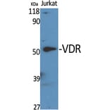 Western Blot - Anti-Vitamin D Receptor Antibody (B1245) - Antibodies.com