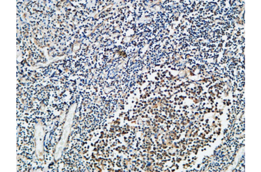 Immunohistochemistry - Anti-Vitamin D Receptor Antibody (B1245) - Antibodies.com