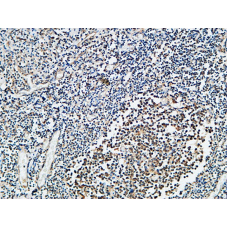 Immunohistochemistry - Anti-Vitamin D Receptor Antibody (B1245) - Antibodies.com