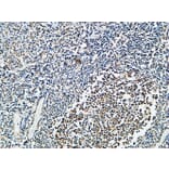 Immunohistochemistry - Anti-Vitamin D Receptor Antibody (B1245) - Antibodies.com