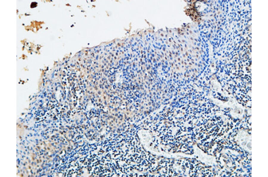 Immunohistochemistry - Anti-Vitamin D Receptor Antibody (B1245) - Antibodies.com