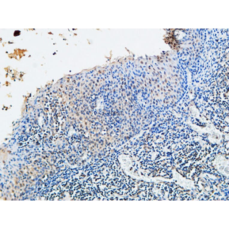 Immunohistochemistry - Anti-Vitamin D Receptor Antibody (B1245) - Antibodies.com
