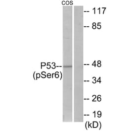 Western Blot - Anti-p53 (phospho Ser6) Antibody (A7185) - Antibodies.com