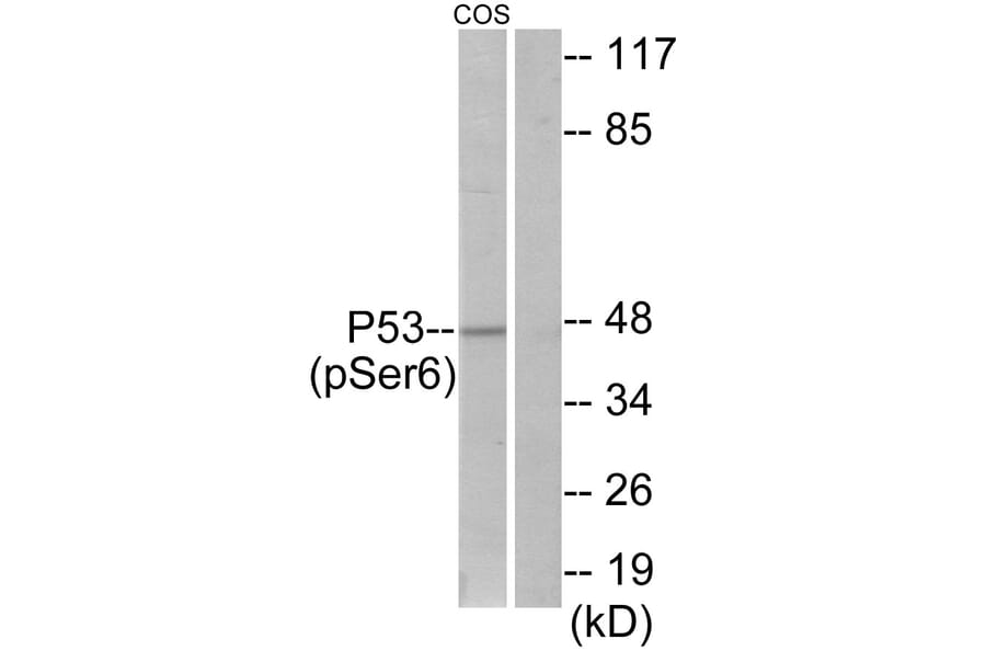 Western Blot - Anti-p53 (phospho Ser6) Antibody (A7185) - Antibodies.com