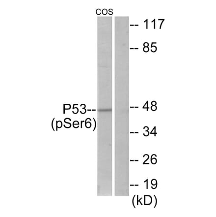 Western Blot - Anti-p53 (phospho Ser6) Antibody (A7185) - Antibodies.com
