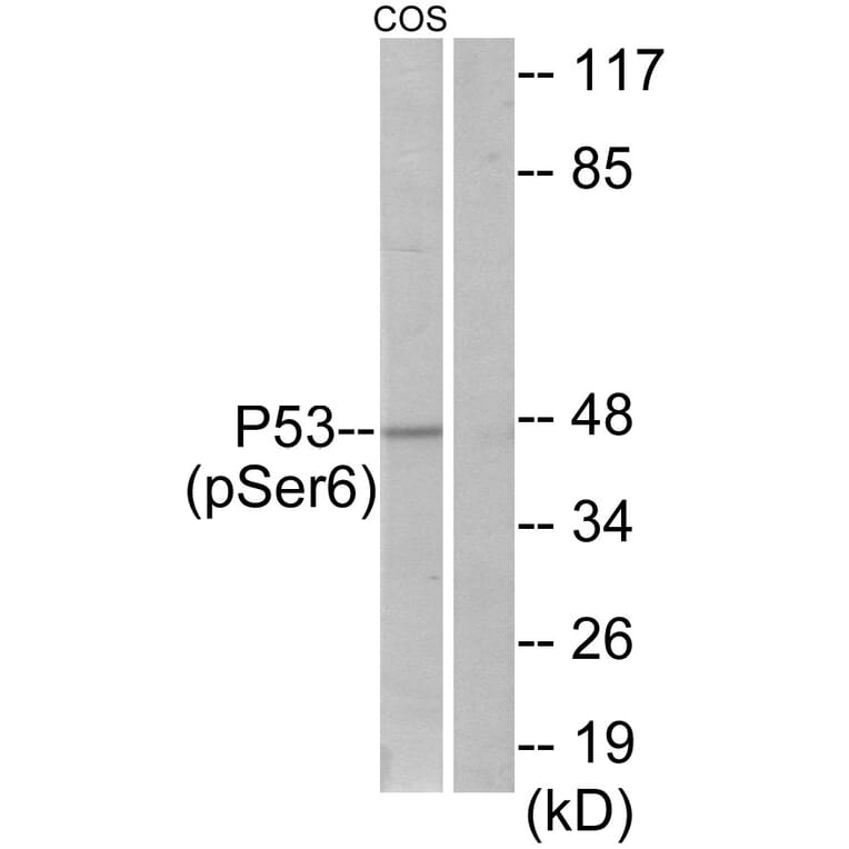 Western Blot - Anti-p53 (phospho Ser6) Antibody (A7185) - Antibodies.com