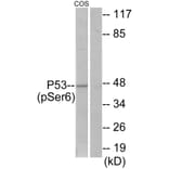 Western Blot - Anti-p53 (phospho Ser6) Antibody (A7185) - Antibodies.com