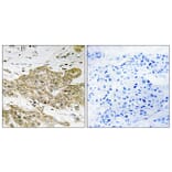 Immunohistochemistry - Anti-p53 (phospho Ser6) Antibody (A7185) - Antibodies.com
