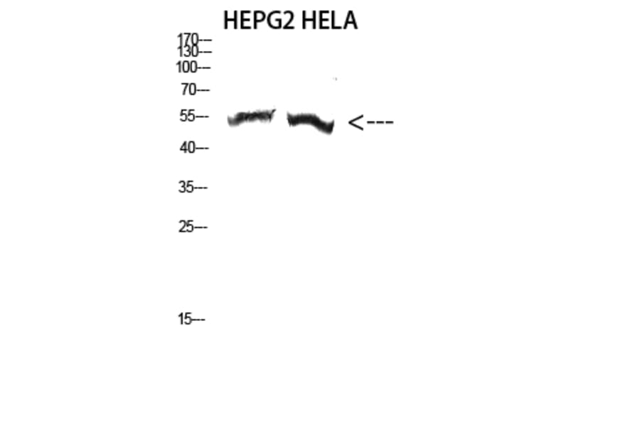Western Blot - Anti-TUBA3C + TUBA3E Antibody (C20908) - Antibodies.com