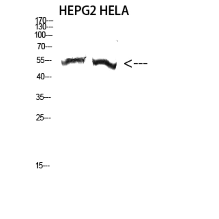 Western Blot - Anti-TUBA3C + TUBA3E Antibody (C20908) - Antibodies.com