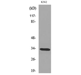 Western Blot - Anti-SFTPA1 + SFTPA2 Antibody (C30119) - Antibodies.com