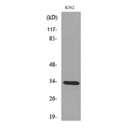 Western Blot - Anti-SFTPA1 + SFTPA2 Antibody (C30119) - Antibodies.com