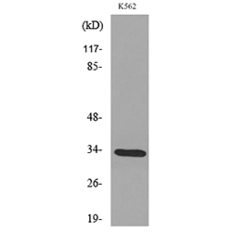 Western Blot - Anti-SFTPA1 + SFTPA2 Antibody (C30119) - Antibodies.com
