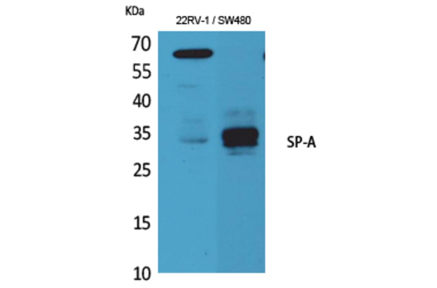 Western Blot - Anti-SFTPA1 + SFTPA2 Antibody (C30119) - Antibodies.com