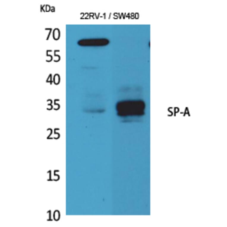 Western Blot - Anti-SFTPA1 + SFTPA2 Antibody (C30119) - Antibodies.com