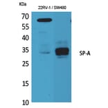 Western Blot - Anti-SFTPA1 + SFTPA2 Antibody (C30119) - Antibodies.com