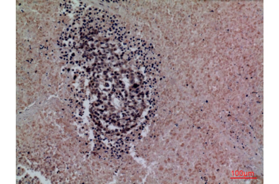Immunohistochemistry - Anti-SFTPA1 + SFTPA2 Antibody (C30119) - Antibodies.com