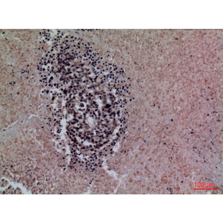 Immunohistochemistry - Anti-SFTPA1 + SFTPA2 Antibody (C30119) - Antibodies.com
