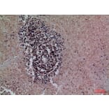 Immunohistochemistry - Anti-SFTPA1 + SFTPA2 Antibody (C30119) - Antibodies.com