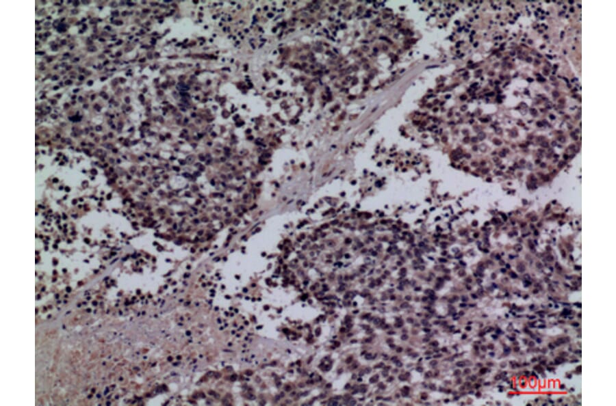 Immunohistochemistry - Anti-SFTPA1 + SFTPA2 Antibody (C30119) - Antibodies.com
