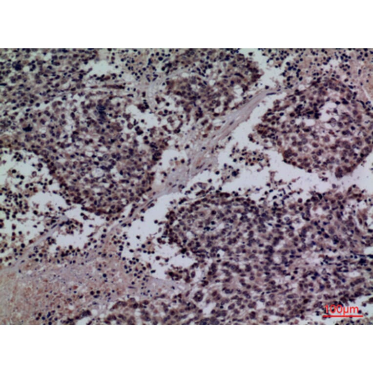 Immunohistochemistry - Anti-SFTPA1 + SFTPA2 Antibody (C30119) - Antibodies.com