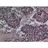 Immunohistochemistry - Anti-SFTPA1 + SFTPA2 Antibody (C30119) - Antibodies.com