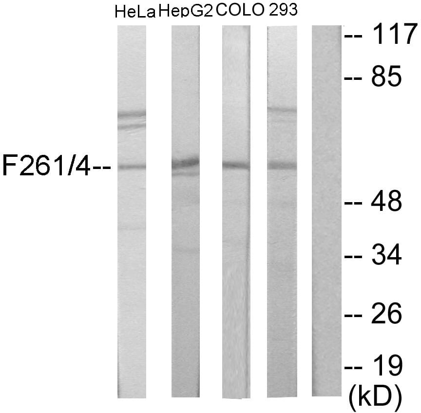 Western blot analysis of lysates from HeLa, HepG COLO205, and 293 cells using Anti-PFKFB1 + PFKFB4 Antibody. The right hand lane represents a negative control, where the antibody is blocked by the immunising peptide.