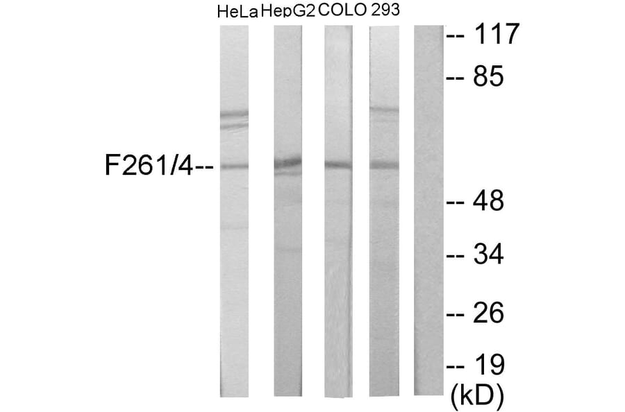 Western Blot - Anti-PFKFB1 + PFKFB4 Antibody (C11146) - Antibodies.com