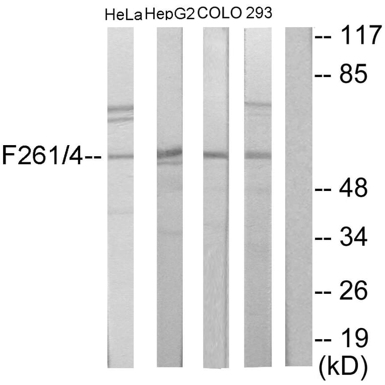 Western Blot - Anti-PFKFB1 + PFKFB4 Antibody (C11146) - Antibodies.com
