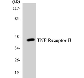 Western Blot - Anti-TNF Receptor II Antibody (R12-3635) - Antibodies.com