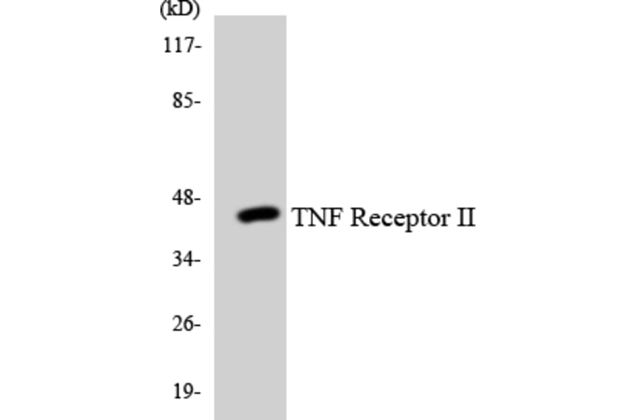 Western Blot - Anti-TNF Receptor II Antibody (R12-3635) - Antibodies.com