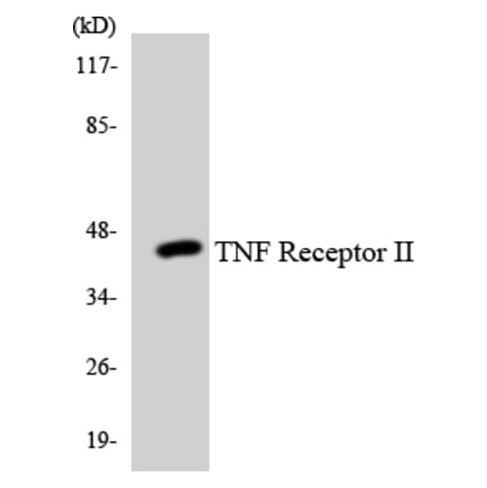 Western Blot - Anti-TNF Receptor II Antibody (R12-3635) - Antibodies.com