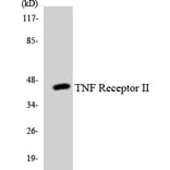 Western Blot - Anti-TNF Receptor II Antibody (R12-3635) - Antibodies.com
