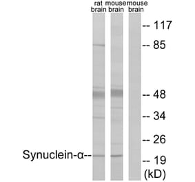 Western Blot - Anti-Synuclein-alpha Antibody (B7234) - Antibodies.com