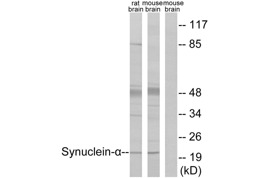 Western Blot - Anti-Synuclein-alpha Antibody (B7234) - Antibodies.com