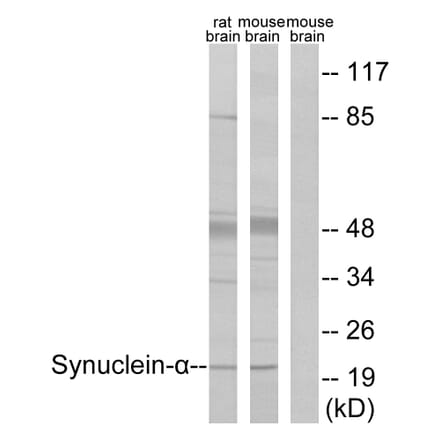Western Blot - Anti-Synuclein-alpha Antibody (B7234) - Antibodies.com